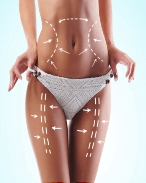 Lipo cavitation