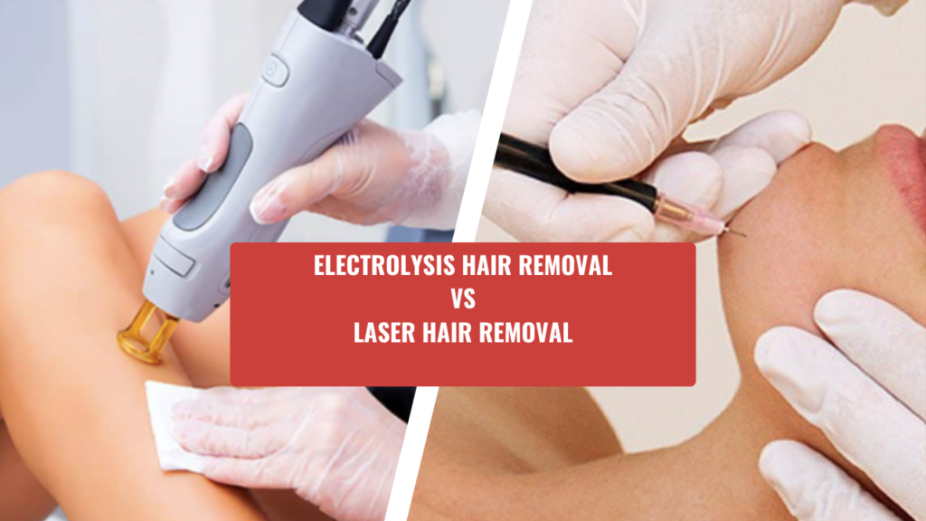 This contains an image of two pictures depicting how Electrolysis permanent hair removal and laser hair removal is done with the text Electrolysis Hair Removal Vs Laser Hair Removal written on it