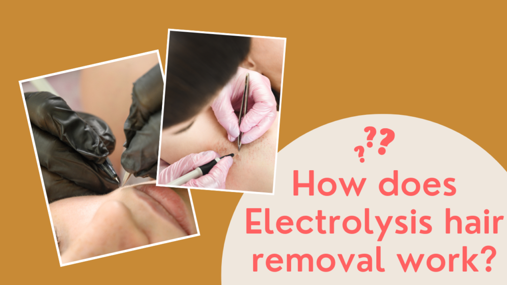 This contain an image of How-does-Electrolysis-hair-removal-work