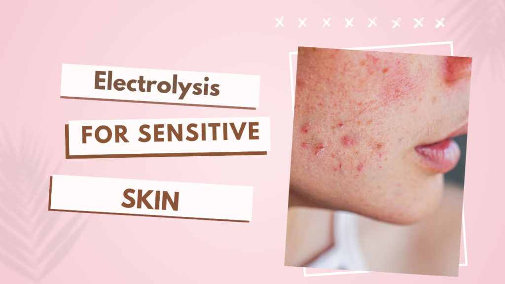 This contain an image of a sensitive skin person having redness, irritation, or inflammation.