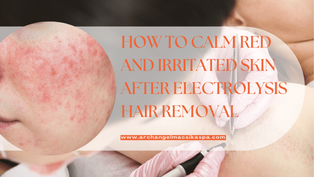 This contains the text "How to Calm Red and Irritated Skin After Electrolysis Hair Removal"and an image of an irritated skin around the chin.